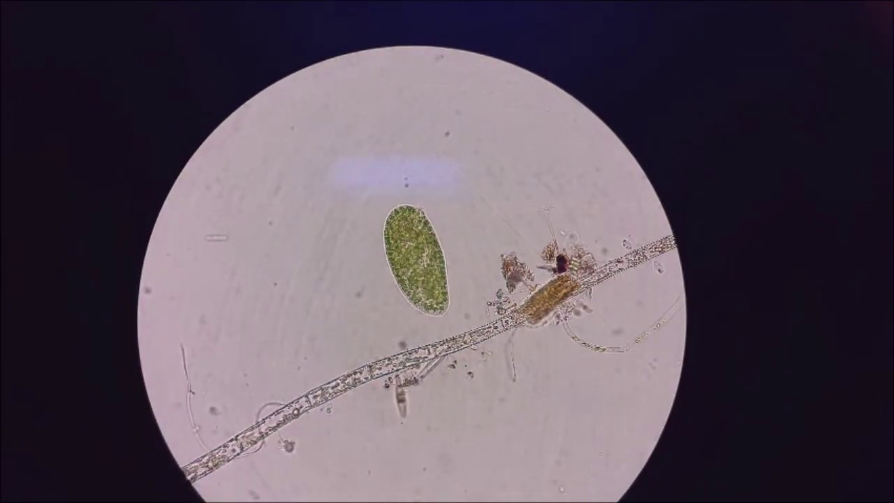 Descubre el fascinante mundo del agua de charco en el microscopio
